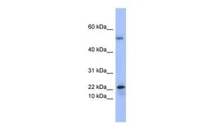 WB analysis of human fetal thymus tissue using GTX47160 PLA2G5 antibody at 0.2-1microg/ml. WB analysis of human fetal thymus tissue using GTX47160 PLA2G5 antibody at 0.2-1microg/ml.