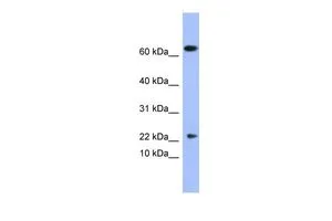WB analysis of human fetal thymus tissue using GTX47161 PLA2G5 antibody at 0.2-1microg/ml. WB analysis of human fetal thymus tissue using GTX47161 PLA2G5 antibody at 0.2-1microg/ml.
