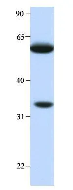 WB analysis of human liver tissue using GTX47164 HRG antibody at 1microg/ml.