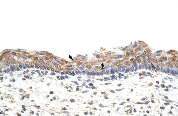 IHC-P analysis of human skin tissue using GTX47168 GNB1L antibody at 4-8microg/ml. IHC-P analysis of human skin tissue using GTX47168 GNB1L antibody at 4-8microg/ml.