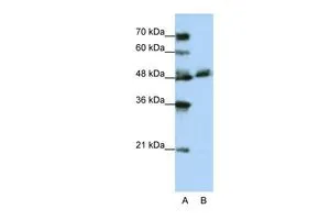 WB analysis of Jurkat cells using GTX47170 WDR13 antibody at 1.25microg/ml. Lane A : marker Lane B : Jurkat cells WB analysis of Jurkat cells using GTX47170 WDR13 antibody at 1.25microg/ml. Lane A : marker Lane B : Jurkat cells