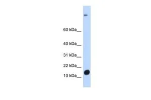 WB analysis of human muscle tissue using GTX47179 C6ORF201 antibody at 0.2-1microg/ml. WB analysis of human muscle tissue using GTX47179 C6ORF201 antibody at 0.2-1microg/ml.