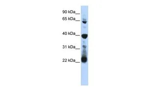 WB analysis of human B lymphoblast cells using GTX47194 RPUSD3 antibody at 0.2-1microg/ml. WB analysis of human B lymphoblast cells using GTX47194 RPUSD3 antibody at 0.2-1microg/ml.
