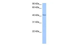 WB analysis of Jurkat cells using GTX47204 DCP2 antibody at 0.2-1microg/ml. WB analysis of Jurkat cells using GTX47204 DCP2 antibody at 0.2-1microg/ml.