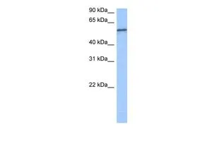 WB analysis of Jurkat cells using GTX47210 RPUSD2 antibody at 0.2-1microg/ml. WB analysis of Jurkat cells using GTX47210 RPUSD2 antibody at 0.2-1microg/ml.