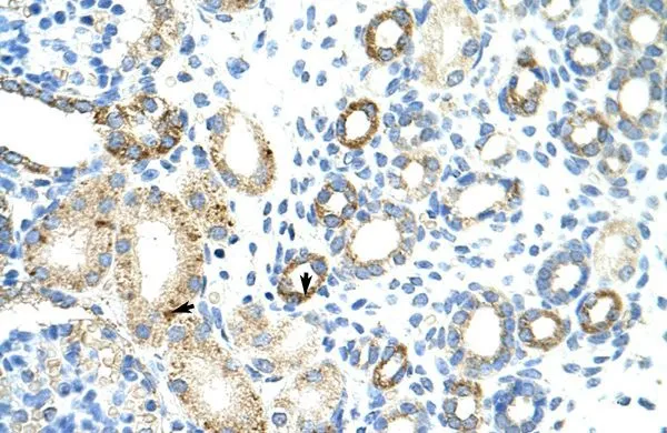 IHC-P analysis of human kidney tissue using GTX47212 MGC27016 antibody at 4.0-8.0microg/ml. IHC-P analysis of human kidney tissue using GTX47212 MGC27016 antibody at 4.0-8.0microg/ml.