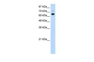 WB analysis of Jurkat cells using GTX47212 MGC27016 antibody at 0.2-1microg/ml.