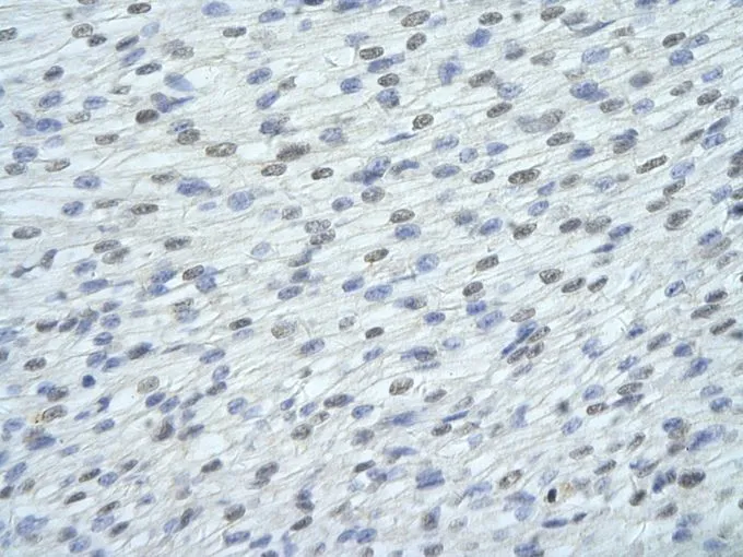 IHC-P analysis of human heart tissue using GTX47232 FUSIP1 antibody at 4.0-8.0microg/ml.