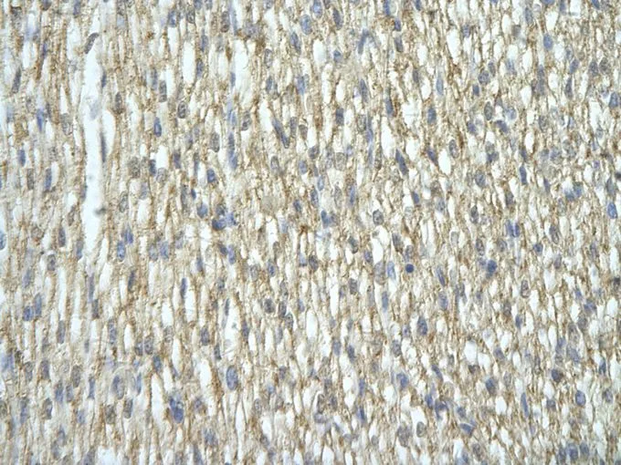 IHC-P analysis of human heart tissue using GTX47243 HNRNPA2B1 antibody at 4.0-8.0microg/ml. IHC-P analysis of human heart tissue using GTX47243 HNRNPA2B1 antibody at 4.0-8.0microg/ml.