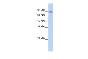 WB analysis of human fetal lung tissue using GTX47246 CPEB4 antibody at 0.2-1microg/ml. WB analysis of human fetal lung tissue using GTX47246 CPEB4 antibody at 0.2-1microg/ml.