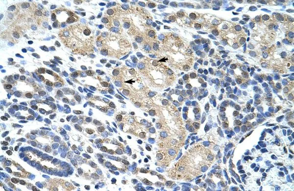 IHC-P analysis of human kidney tissue using GTX47262 WBSCR1 antibody at 4.0-8.0microg/ml. IHC-P analysis of human kidney tissue using GTX47262 WBSCR1 antibody at 4.0-8.0microg/ml.