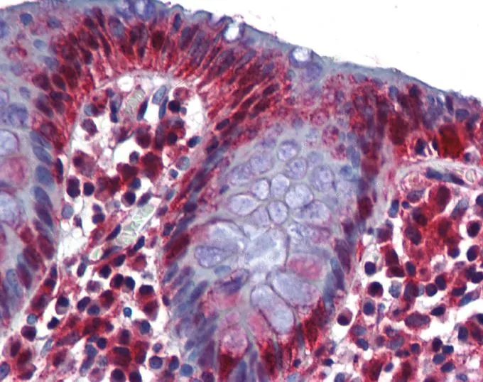 IHC-P analysis of human colon tissue using GTX47272 RBM47 antibody at 5microg/ml. IHC-P analysis of human colon tissue using GTX47272 RBM47 antibody at 5microg/ml.