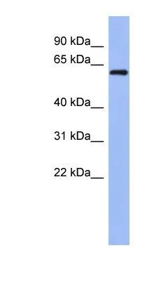 WB analysis of NCI-H226 cells using GTX47272 RBM47 antibody at 0.2-1microg/ml.