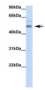 WB analysis of human fetal lung tissue using GTX47272 RBM47 antibody at 1.0microg/ml.