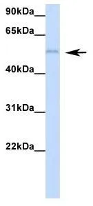 WB analysis of human placenta tissue using GTX47272 RBM47 antibody at 1.0microg/ml.