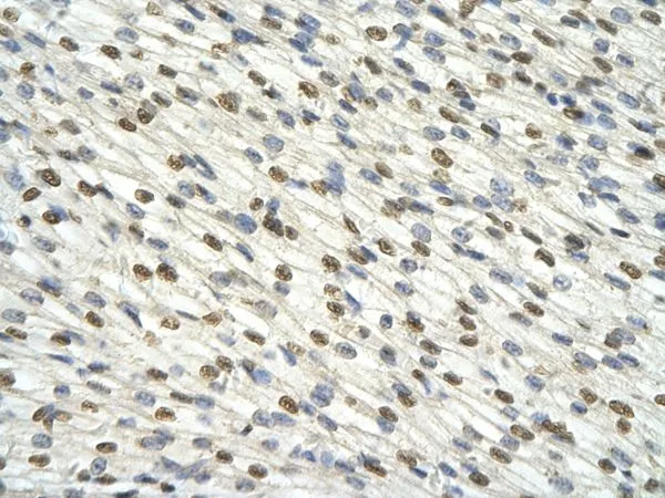 IHC-P analysis of human heart tissue using GTX47277 DAZAP1 antibody at 4.0-8.0microg/ml.