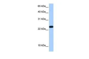 WB analysis of human placenta tissue using GTX47288 C19ORF24 antibody at 0.2-1microg/ml. WB analysis of human placenta tissue using GTX47288 C19ORF24 antibody at 0.2-1microg/ml.