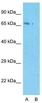 WB analysis of HeLa cells using GTX47301 LARP7 antibody at 1microg/ml. Lane A : Primary antibody Lane B : Primary antibody + Blocking peptide WB analysis of HeLa cells using GTX47301 LARP7 antibody at 1microg/ml. Lane A : Primary antibody Lane B : Primary antibody + Blocking peptide