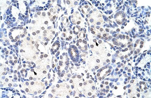 IHC-P analysis of human kidney tissue using GTX47305 NIP7 antibody at 4.0-8.0microg/ml. IHC-P analysis of human kidney tissue using GTX47305 NIP7 antibody at 4.0-8.0microg/ml.