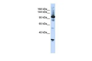 WB analysis of HeLa cells using GTX47314 DIS3 antibody at 0.2-1microg/ml.