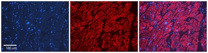 IHC-P analysis of human heart tissue using GTX47320 LSM1 antibody at 1:600. Left to right : DAPI, LSM1, Merge. Low pH, heat-induced antigen retrieval method utilizing Sodium Citrate buffer. IHC-P analysis of human heart tissue using GTX47320 LSM1 antibody at 1:600. Left to right : DAPI, LSM1, Merge. Low pH, heat-induced antigen retrieval method utilizing Sodium Citrate buffer.