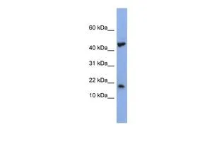 WB analysis of NCI-H226 cells using GTX47320 LSM1 antibody at 0.2-1microg/ml.