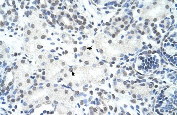 IHC-P analysis of human kidney tissue using GTX47329 HNRPH3 antibody at 4.0-8.0microg/ml. IHC-P analysis of human kidney tissue using GTX47329 HNRPH3 antibody at 4.0-8.0microg/ml.