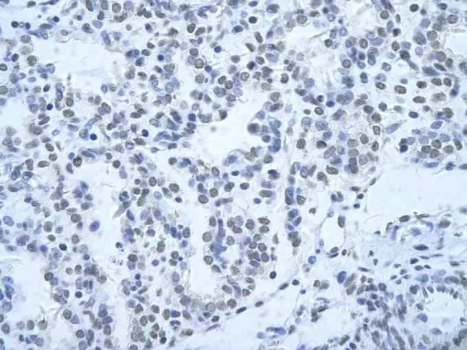 IHC-P analysis of human lung tissue using GTX47329 HNRPH3 antibody at 4.0-8.0microg/ml.