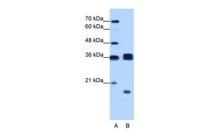 WB analysis of Raji cells using GTX47329 HNRPH3 antibody at 1.0microg/ml. Lane A : marker Lane B : Raji cells