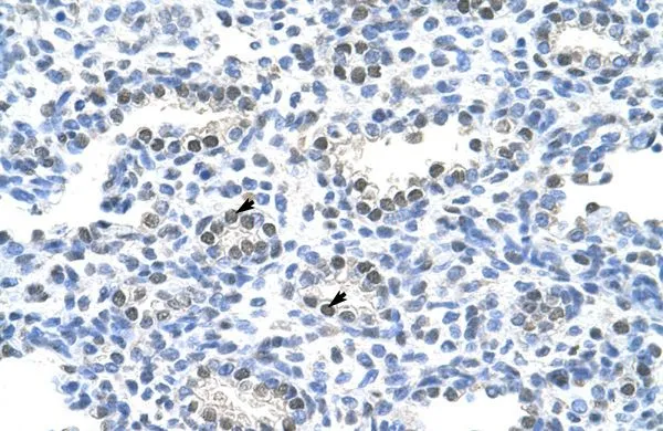 IHC-P analysis of human lung tissue using GTX47344 PAIP1 antibody at 4.0-8.0microg/ml. IHC-P analysis of human lung tissue using GTX47344 PAIP1 antibody at 4.0-8.0microg/ml.
