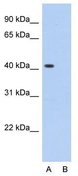WB analysis of HepG2 cells using GTX47350 PCBP1 antibody at 2microg/ml. Lane A : Primary antibody Lane B : Primary antibody + Blocking peptide