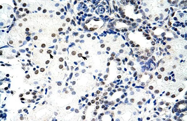 IHC-P analysis of human kidney tissue using GTX47363 NCL antibody at 4.0-8.0microg/ml. IHC-P analysis of human kidney tissue using GTX47363 NCL antibody at 4.0-8.0microg/ml.