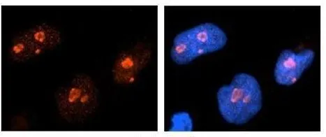 ICC/IF analysis of NT-2 cells using GTX47363 NCL antibody at 1:500. Red: NCL Blue:DAPI