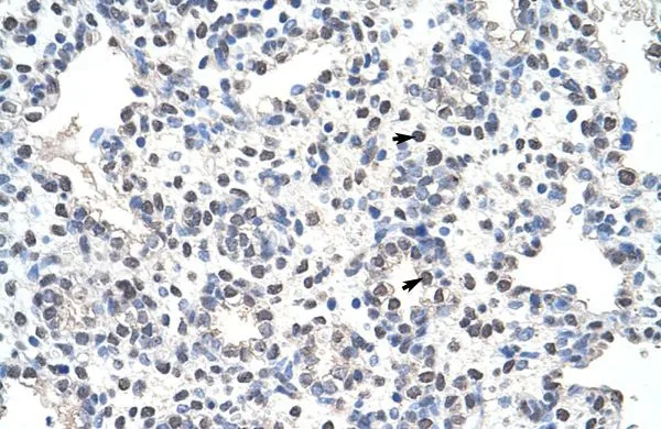 IHC-P analysis of human lung tissue using GTX47364 NCL antibody at 4.0-8.0microg/ml.