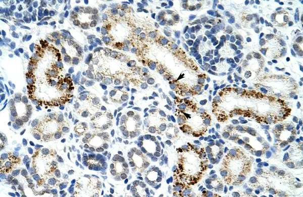 IHC-P analysis of human kidney tissue using GTX47366 ZRSR2 antibody at 4.0-8.0microg/ml. IHC-P analysis of human kidney tissue using GTX47366 ZRSR2 antibody at 4.0-8.0microg/ml.