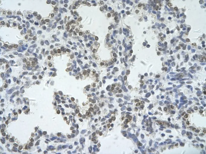 IHC-P analysis of human lung tissue using GTX47366 ZRSR2 antibody at 4.0-8.0microg/ml.