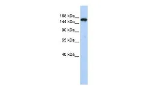 WB analysis of HepG2 cells using GTX47370 SYNJ1 antibody at 0.2-1microg/ml. WB analysis of HepG2 cells using GTX47370 SYNJ1 antibody at 0.2-1microg/ml.