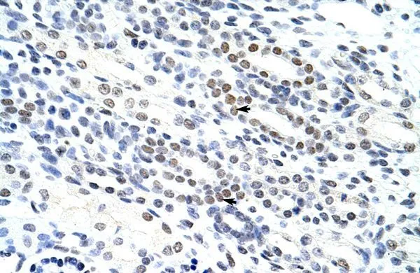 IHC-P analysis of human kidney tissue using GTX47373 NOL4 antibody at 4.0-8.0microg/ml. IHC-P analysis of human kidney tissue using GTX47373 NOL4 antibody at 4.0-8.0microg/ml.