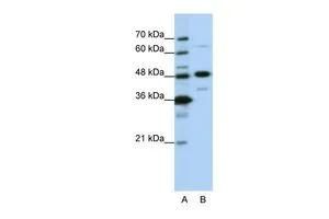 WB analysis of HepG2 cells using GTX47373 NOL4 antibody at 0.2-1microg/ml. Lane A : marker Lane B : HepG2 cells