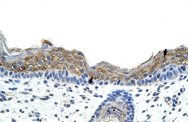 IHC-P analysis of human skin tissue using GTX47380 SRP19 antibody at 4.0-8.0microg/ml. IHC-P analysis of human skin tissue using GTX47380 SRP19 antibody at 4.0-8.0microg/ml.