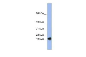 WB analysis of human fetal spleen tissue using GTX47387 Ribonuclease A antibody at 0.2-1microg/ml. WB analysis of human fetal spleen tissue using GTX47387 Ribonuclease A antibody at 0.2-1microg/ml.
