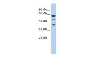 WB analysis of human fetal spleen tissue using GTX47390 NELF-E antibody at 0.2-1microg/ml. WB analysis of human fetal spleen tissue using GTX47390 NELF-E antibody at 0.2-1microg/ml.
