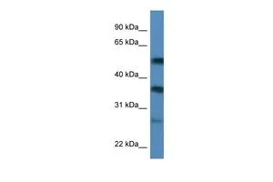 WB analysis of MCF-7 cells using GTX47407 SERBP1 antibody at 0.2-1microg/ml. WB analysis of MCF-7 cells using GTX47407 SERBP1 antibody at 0.2-1microg/ml.