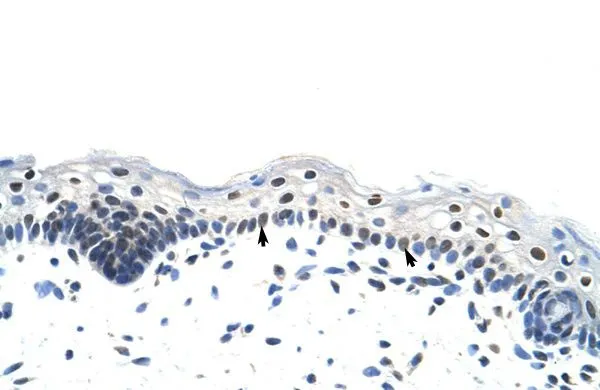 IHC-P analysis of human skin tissue using GTX47410 RP11-78J21.1 antibody at 4.0-8.0microg/ml. IHC-P analysis of human skin tissue using GTX47410 RP11-78J21.1 antibody at 4.0-8.0microg/ml.