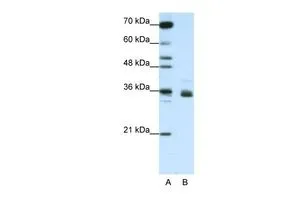 WB analysis of Jurkat cells using GTX47411 RP11-78J21.1 antibody at 1.25microg/ml. Lane A : marker Lane B : Jurkat cells