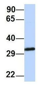 WB analysis of MCF-7 cells using GTX47412 SIP1 antibody at 1.0microg/ml.