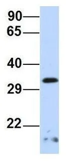 WB analysis of human B lymphoblast cells using GTX47412 SIP1 antibody at 1.0microg/ml.