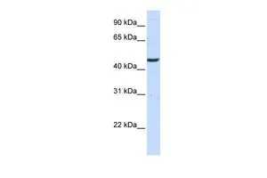 WB analysis of human brain tissue using GTX47414 CCBL2 antibody at 0.2-1microg/ml. WB analysis of human brain tissue using GTX47414 CCBL2 antibody at 0.2-1microg/ml.