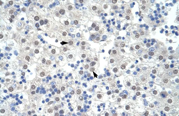 IHC-P analysis of human liver tissue using GTX47418 SF3B1 antibody at 4.0-8.0microg/ml. IHC-P analysis of human liver tissue using GTX47418 SF3B1 antibody at 4.0-8.0microg/ml.