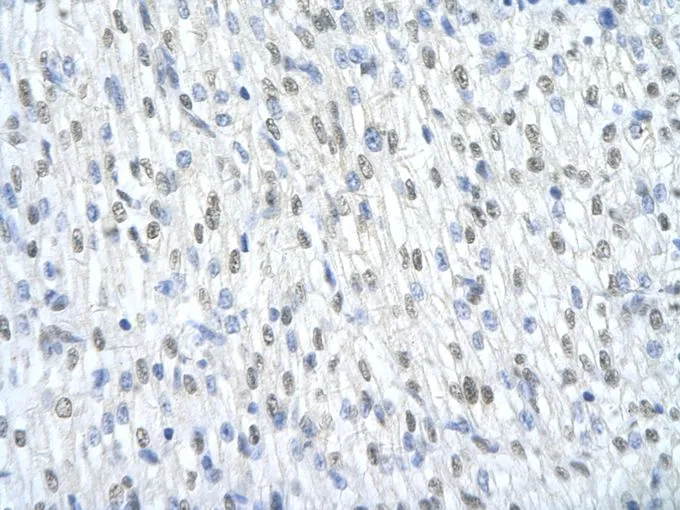 IHC-P analysis of human heart tissue using GTX47418 SF3B1 antibody at 4.0-8.0microg/ml.